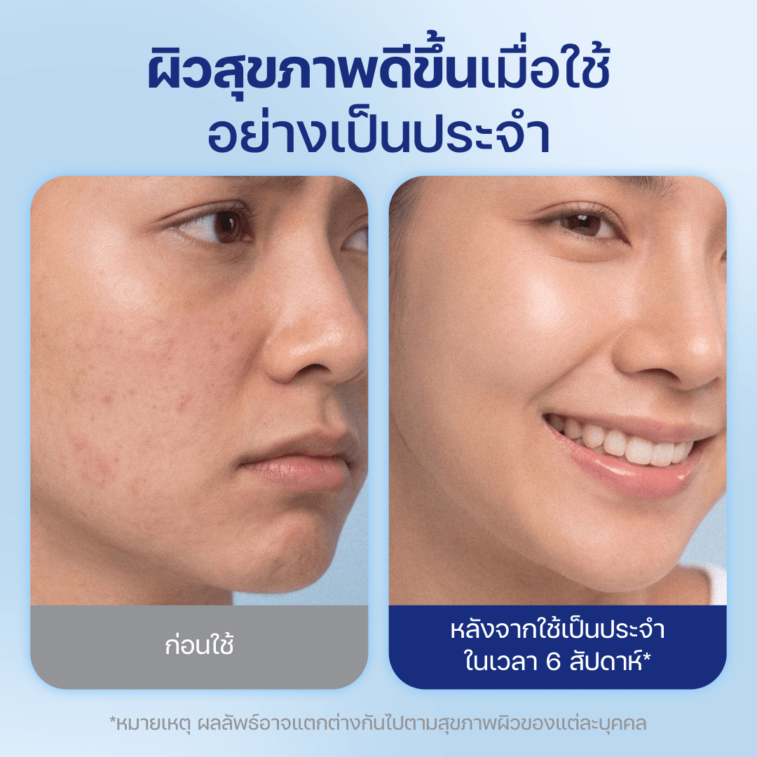 Derma Towels XL